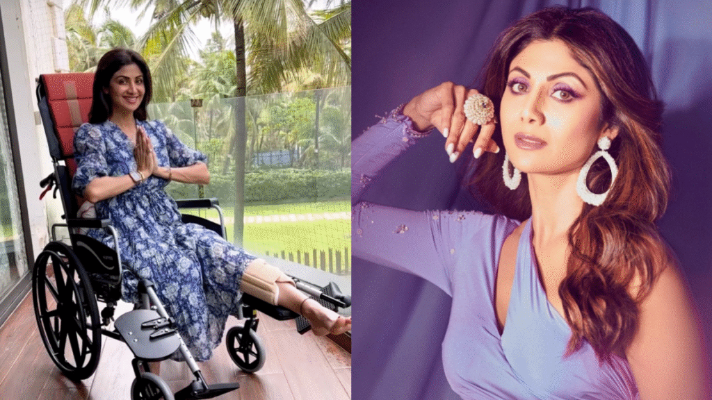 Shilpa Shetty Injury Update: Back on Her Feet After 6 Weeks | Dainik Diary