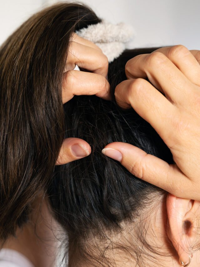 सर्दियों में सिर की खुजली ऐसे होगी हमेशा के लिए खत्म!