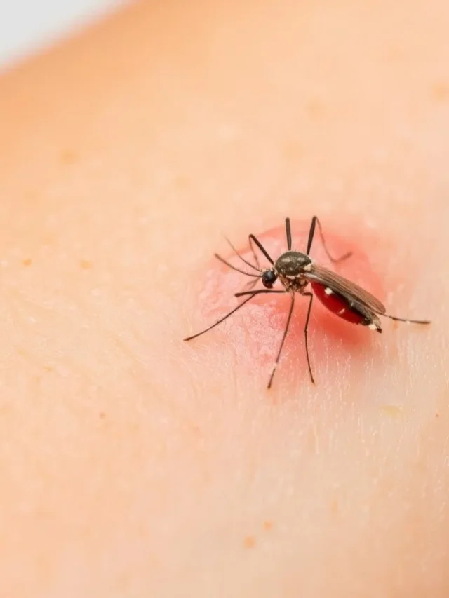 कुछ लोगों को ही मच्छर ज्यादा क्यों काटते हैं जानिए इसके पीछे का चौंकाने वाला कारण